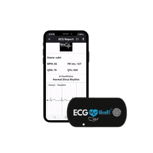 ECG BlueBT — Single-channel Bluetooth ECG that records a medical-grade trace directly to a smartphone or tablet